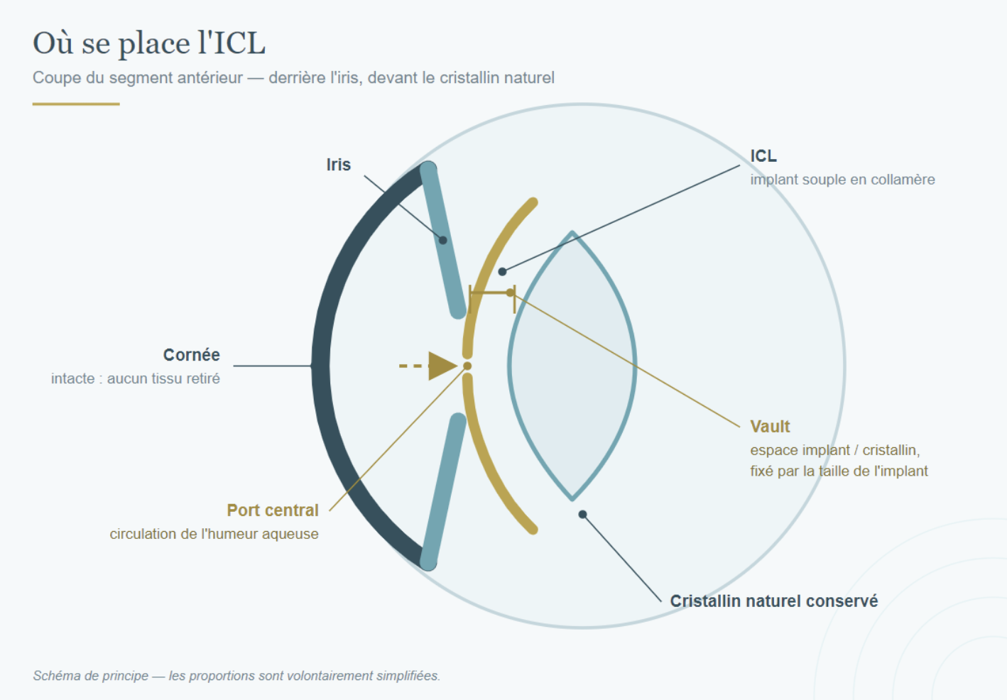 ICL